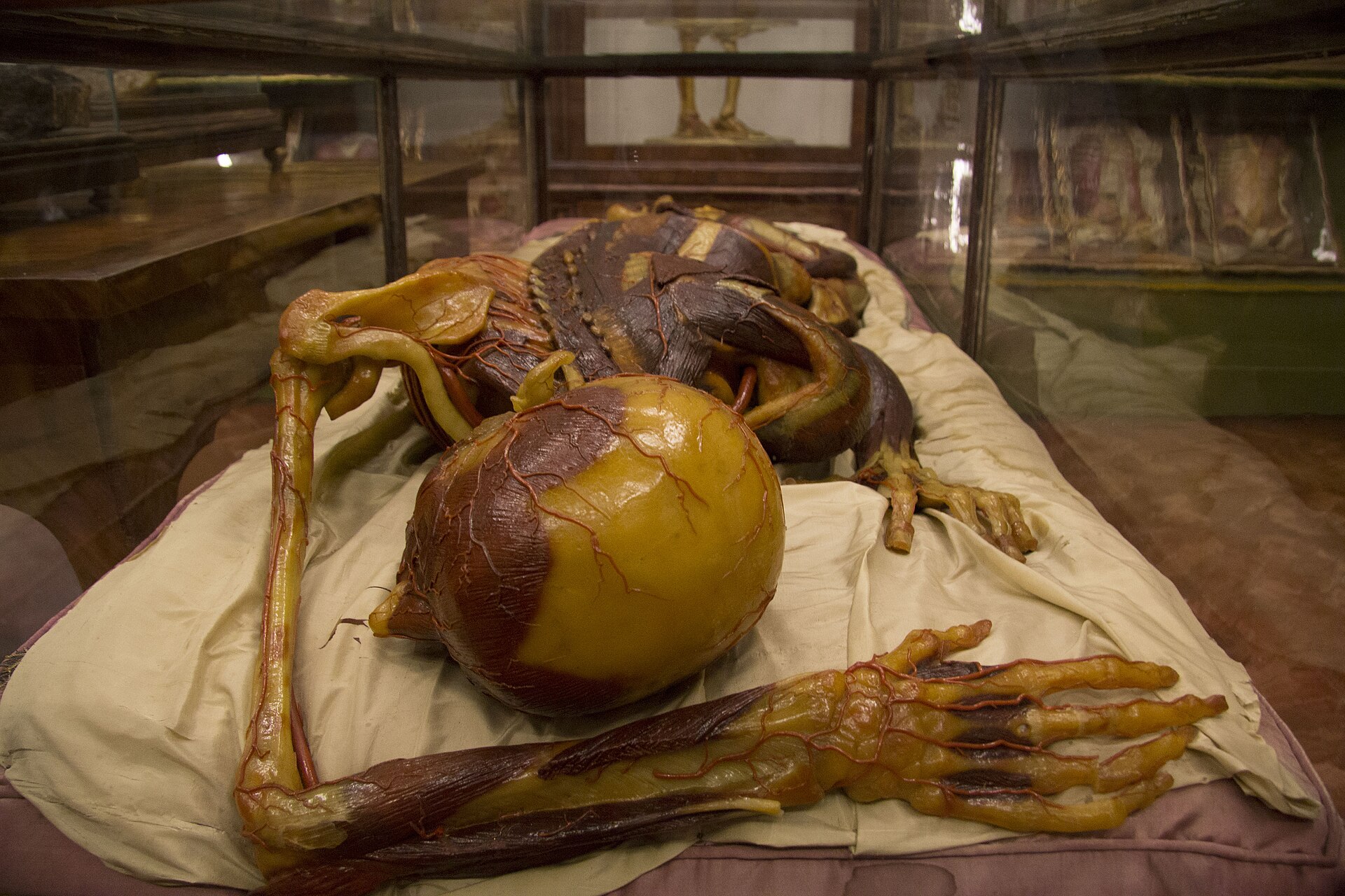 A reclining anatomical wax model with exposed muscles and vessels lies inside a glass display case at La Specola in Florence.